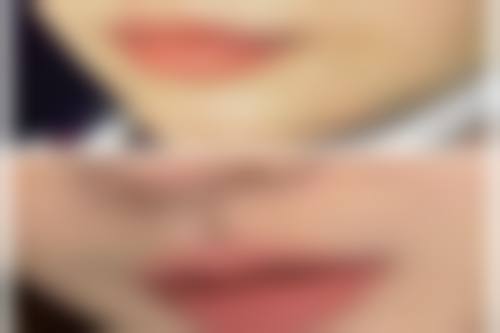 一、惠州市稚美医疗美容怎么样？