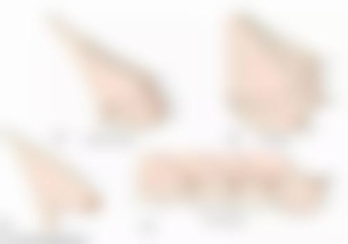 黄金超声炮：适合不同肤质人群的贴心选择