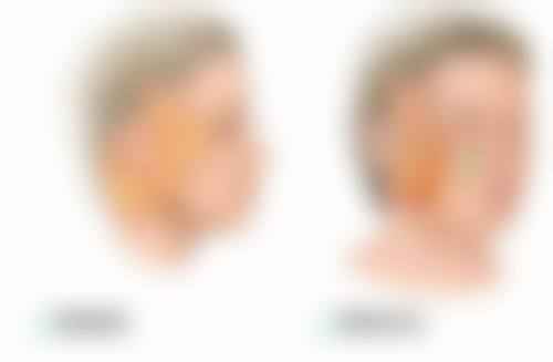 五、東京中央美容外科 TCB 中野院怎么预约：