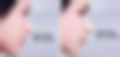 六、威海颜龄医疗美容门诊部价格表：（仅供参考）