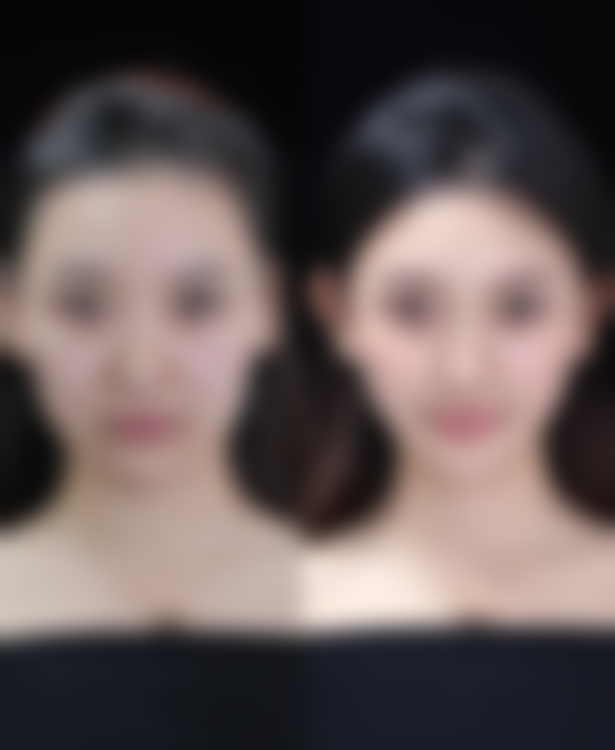 七、茂名博悦整形医院价格表：（仅供参考）