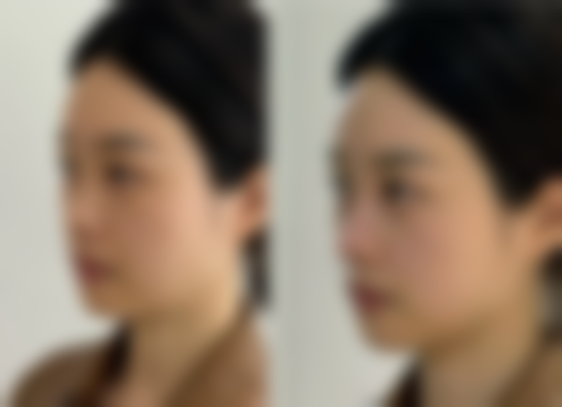 五、广州伊莱曼医疗美容门诊部怎么预约：