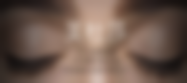 王俊成微整形注射实例