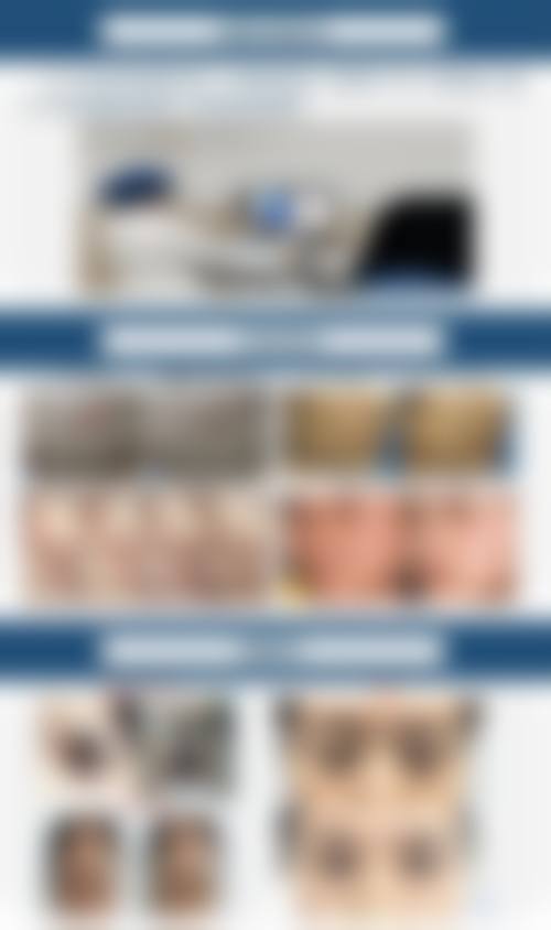 李彩兰皮肤美容实例