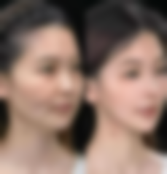 李彩兰皮肤美容水平怎么样可靠吗？