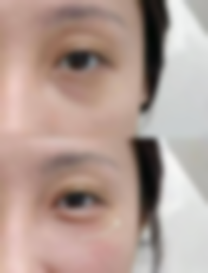 五、昆明医学校第二附属医院烧伤整形科实例