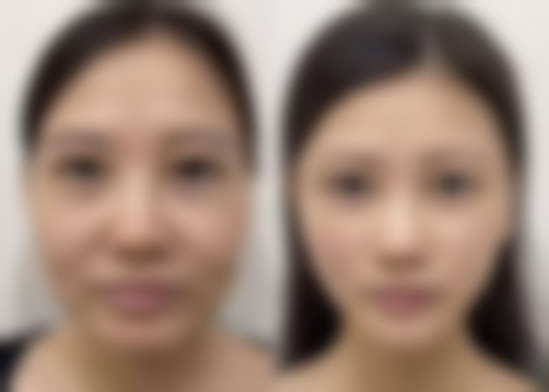 五、合肥安妮薇尔医疗美容门诊部怎么预约：