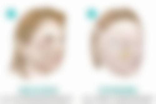 四、宜宾市第三人民医院整形美容科实例