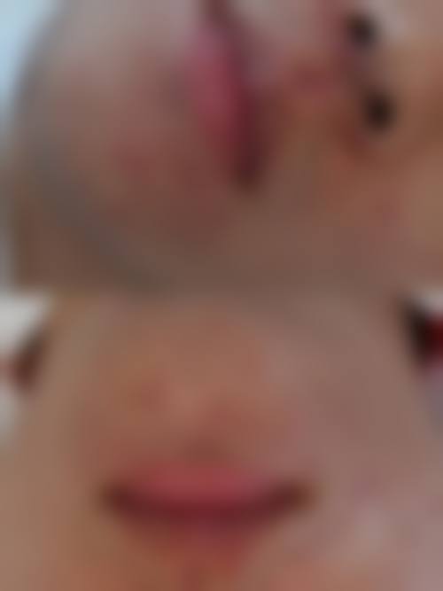 张佳栋怎么预约？