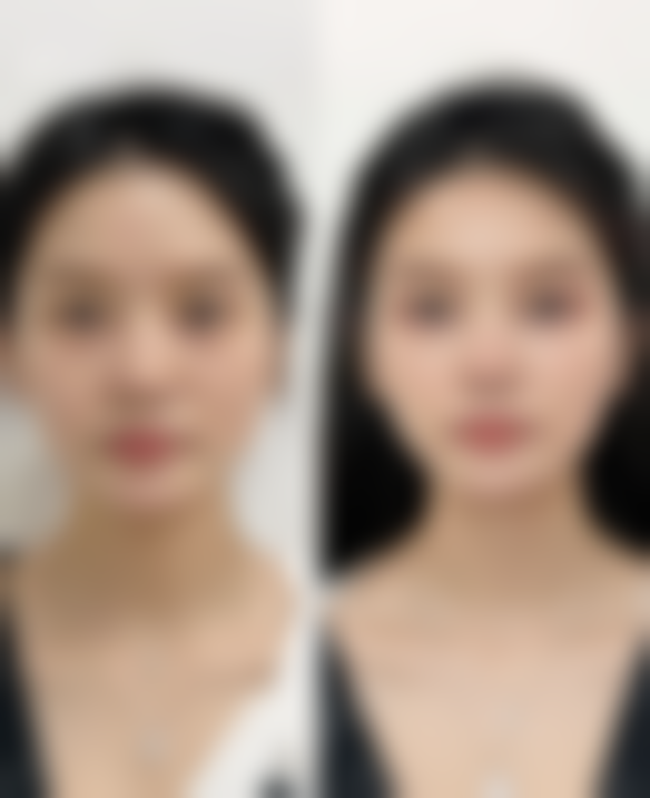 六、南宁康乐瑞泰医疗美容皮肤科诊所价格表：（仅供参考）