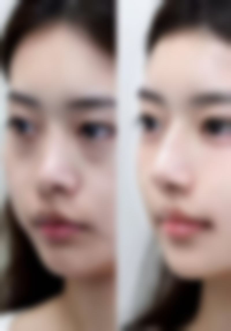 六、玉屏爱美整形医院怎么预约：