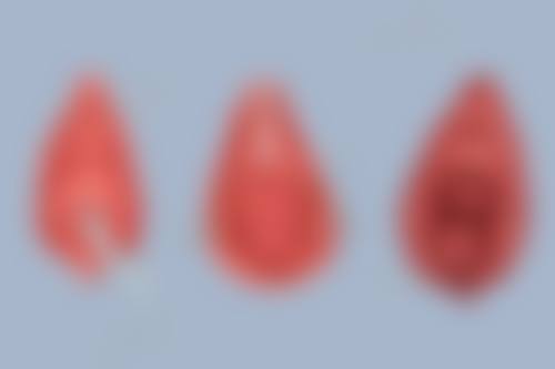 四、洛阳石音医疗美容诊所实例