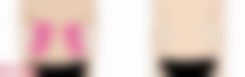 七、韩国时蕴整形外科医院真实的顾客评价如下：