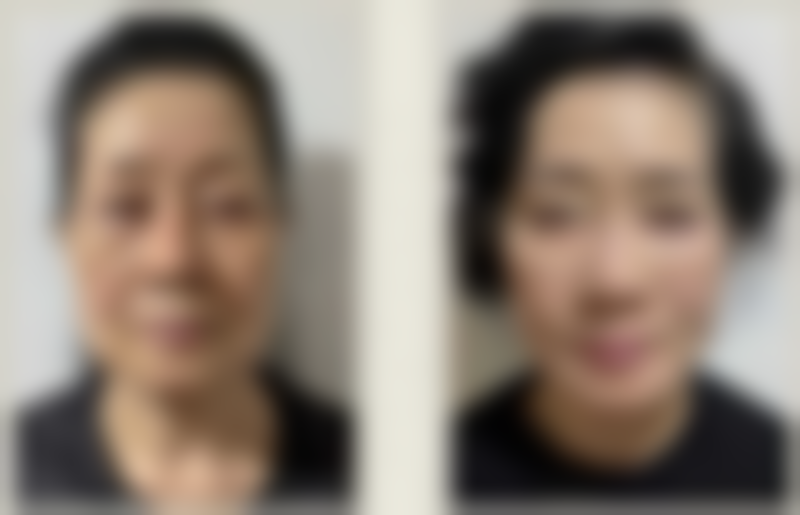 六、北京星美整形医院怎么预约：