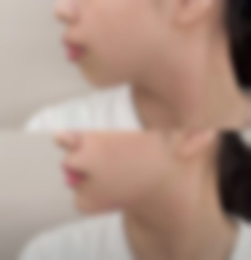 五、深圳汇来医疗美容诊所实例