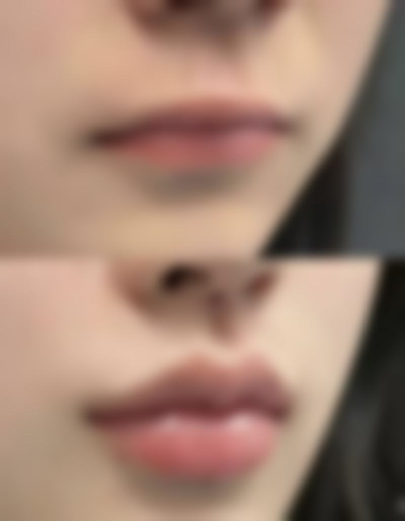 四、韩国时蕴整形外科医院实例