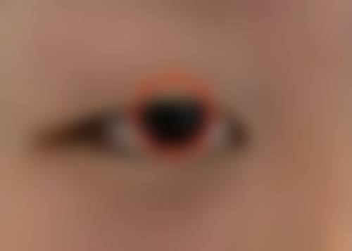 四、衢州柯城丽芯颜整形医院实例