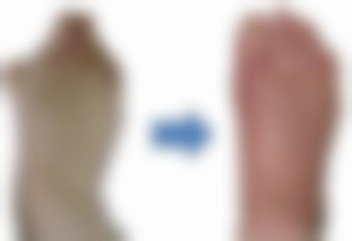 五、广州市尚佳逸韩义医疗美容实例