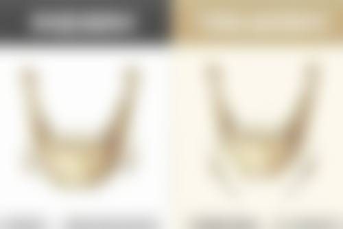 自体肋软骨隆鼻真实范例:看看别人的修复情况