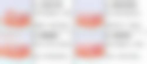 四、成都高新安轻美整形医院实例