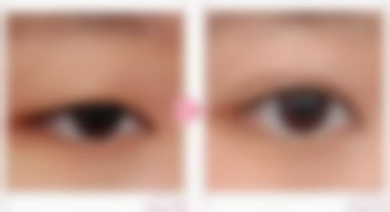 韩国yesterday&today整形外科