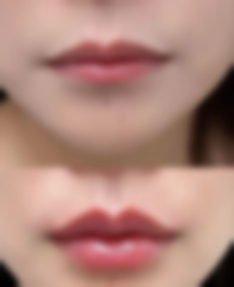 优质医美医院全方面揭秘——以XX医美医院为例