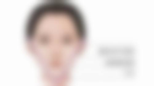 假体隆胸手术时长揭秘：术后修复时间及注意事项