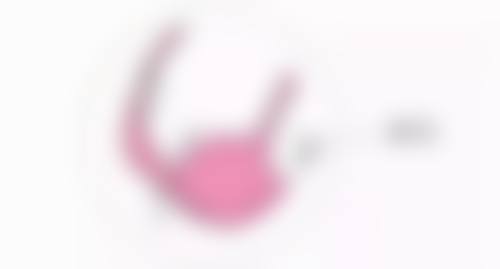 告别多年顽固眼袋有绝招：实例分享坚定信心