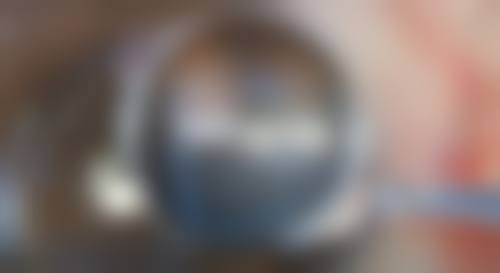 揭秘：医院改善眼部形态问题的多维度方案