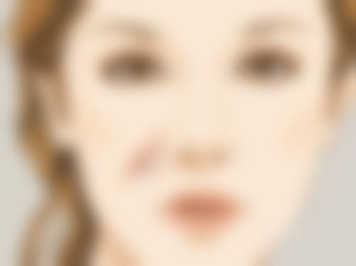 术后留下疤痕不慌张！分阶段处理方案来帮忙