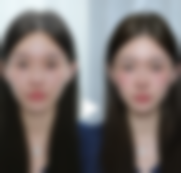 日常护理：热敷搭配眼霜，成效加倍