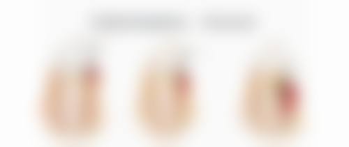 五、韩国GLAM格拉姆整形外科实例