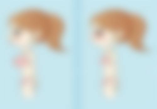 隆鼻鼻头有点歪咋办？多种专业方案助你矫正，重获精致美鼻！ 