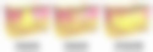 割双眼皮会大出血吗？正规操作与精细护理，让出血可控恢复无忧 