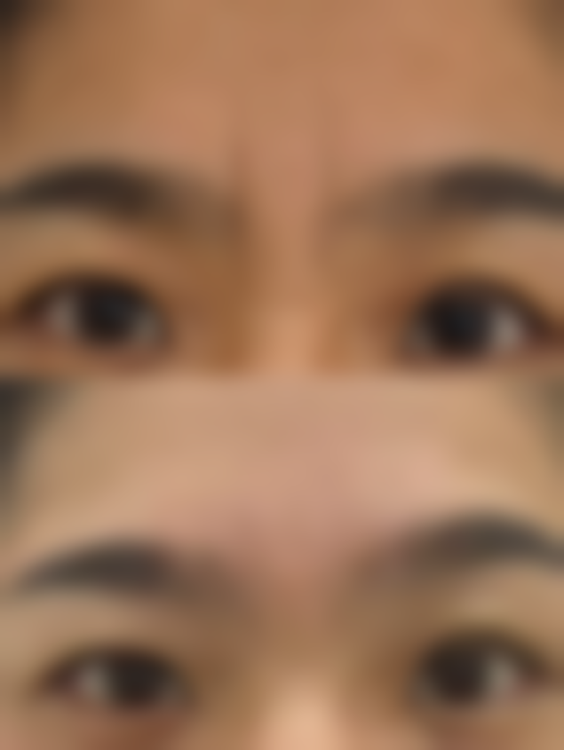 翻白眼对双眼皮的好处