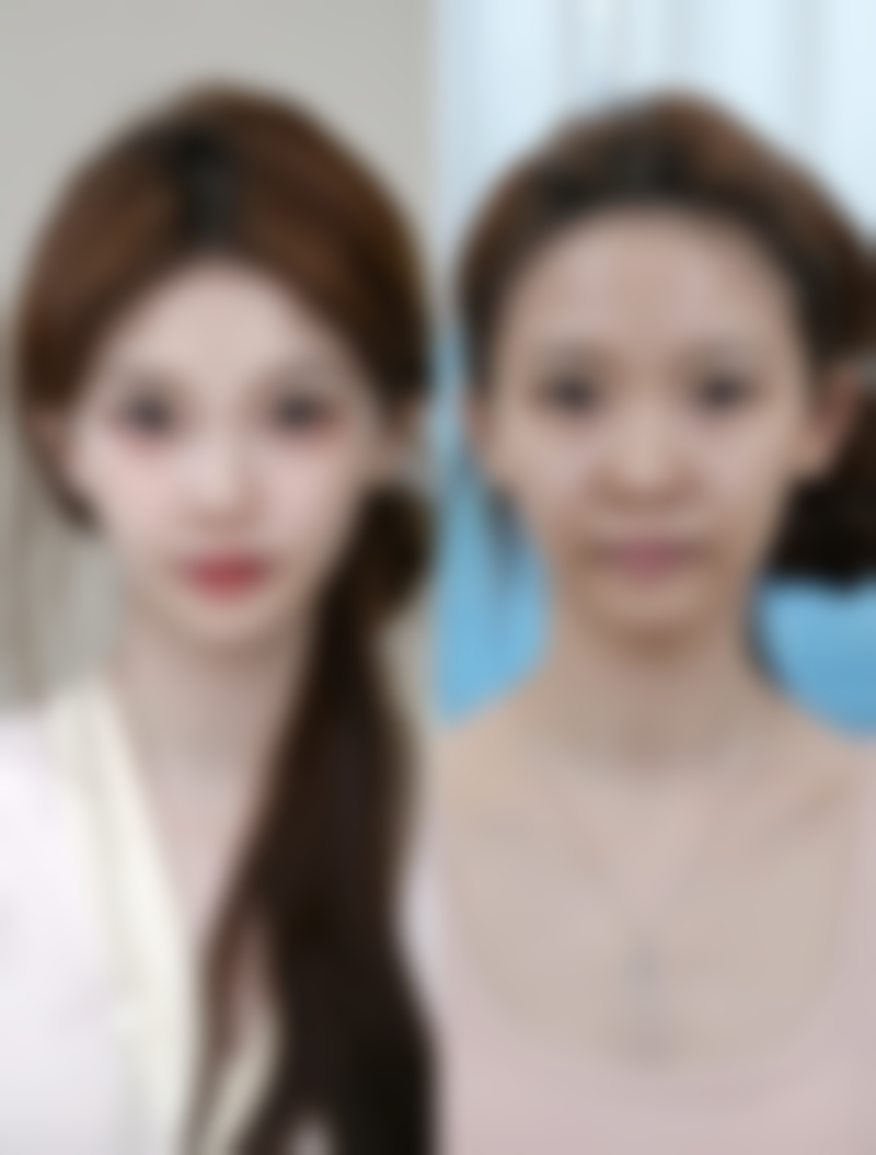 小孩缝针疤痕虽棘手但可改善，专精医院提供优质方案