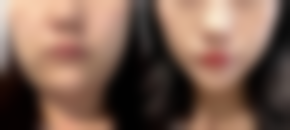 七、郑州美属整形医院真实的顾客评价如下：