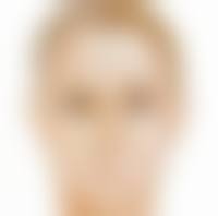 内双眼皮开眼角：选择靠谱医院特别重要