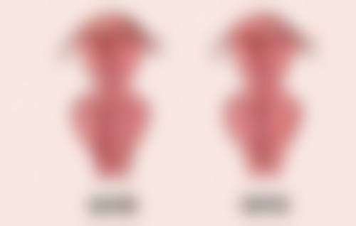 五、广州依柏诗贰号整形医院实例