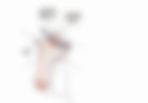 胸口疙瘩不用怕，冷冻治疗显神通