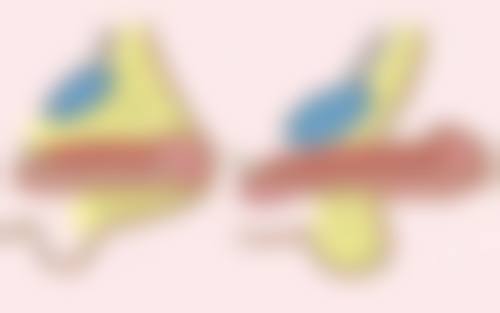 生理期割双眼皮可行吗？选择靠谱医院和医生特别重要