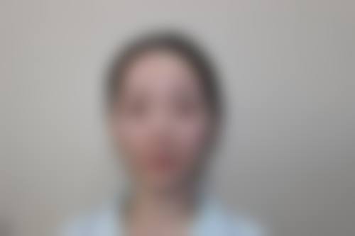 刘文慧眼部整形水平怎么样可靠吗？