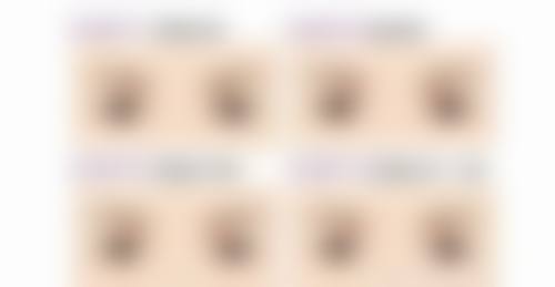 刘文慧眼部整形水平怎么样可靠吗?