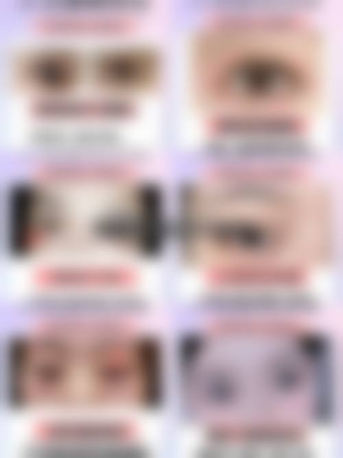 刘文慧眼部整形实例