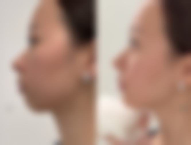 探秘！坚持治疗，肌肤理想修复不是梦