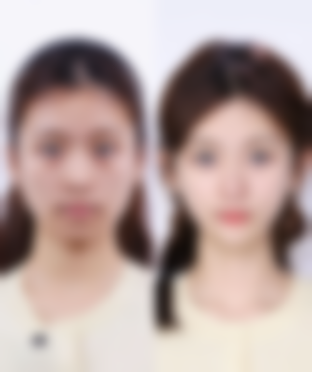 六、成都润美玉之光整形美容医院价格表：（仅供参考）