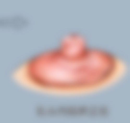 想知道祛疤价格多少?不同方法费用有差异