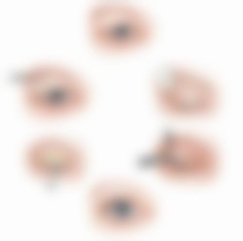 炎症反应,让疤痕颜色“雪上加霜”?