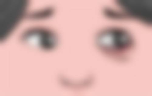 小针除皱联合治疗：对抗静态纹的秘密武器