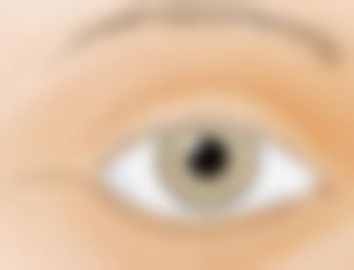 假体隆胸后取出疼感可控吗？了解术中术后护理要点，畅享舒适恢复体验 